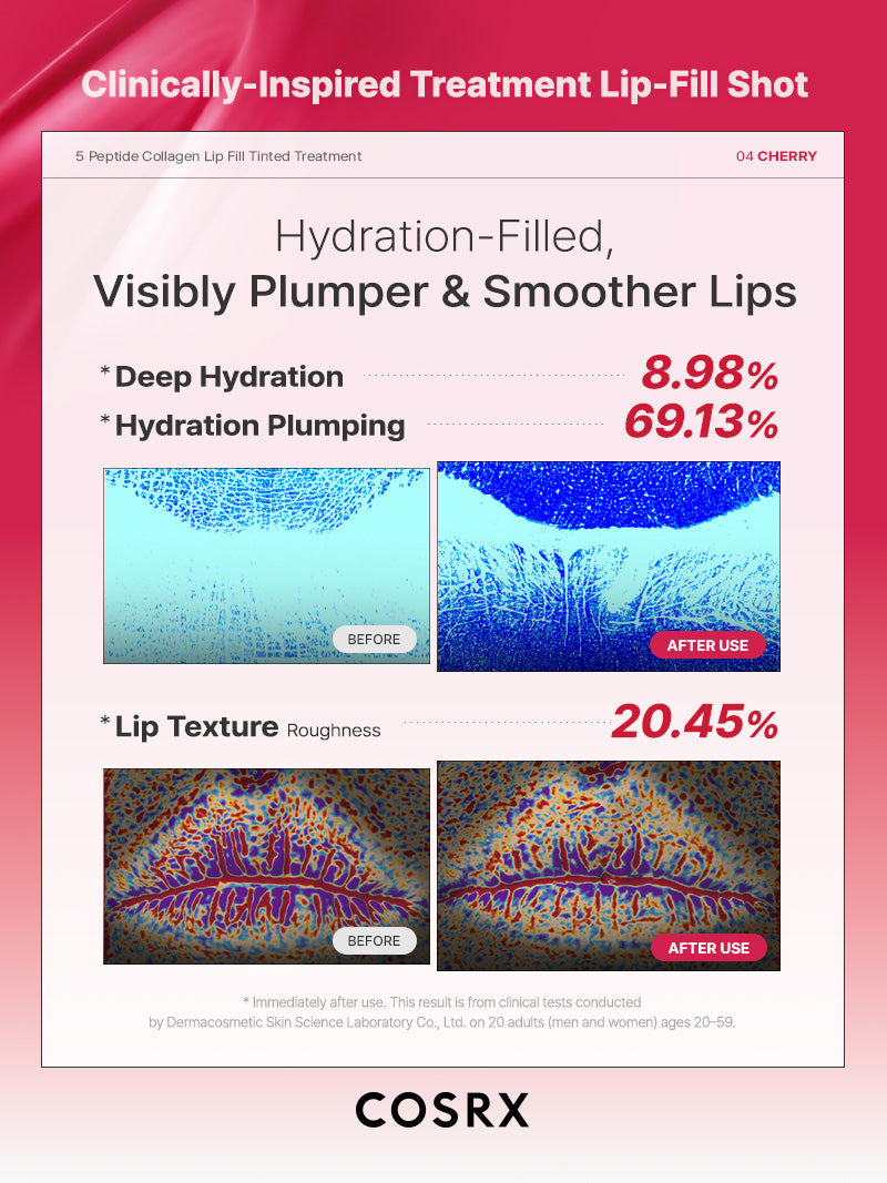5 Peptide Collagen Tinted Lip Fill Treatment