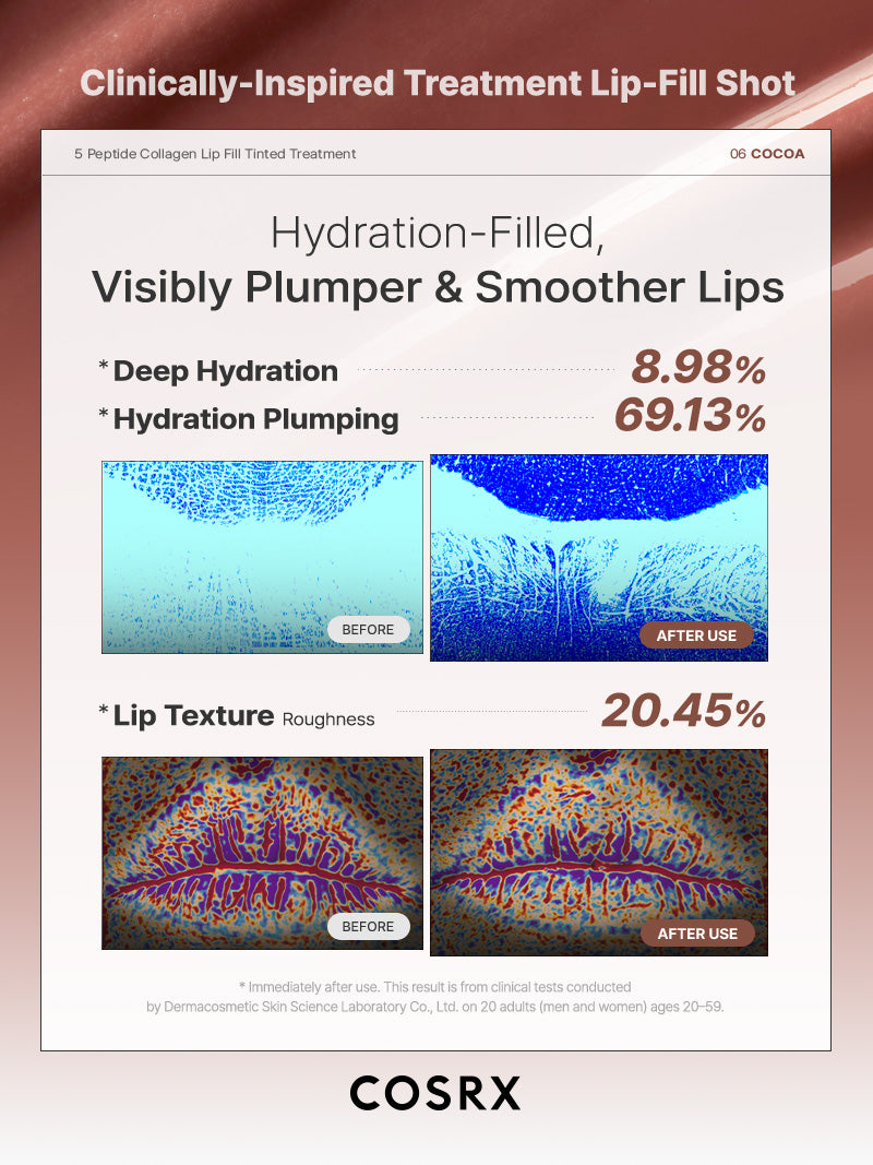 5 Peptide Collagen Tinted Lip Fill Treatment