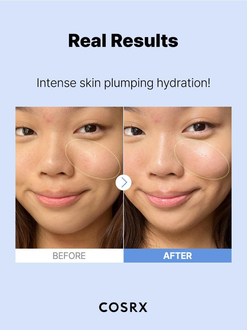 24-HR Synergy Duo (Acne Free)